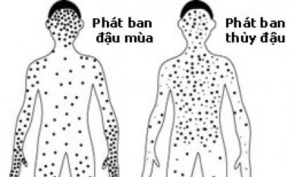 thuy-dau-va-dau-mua